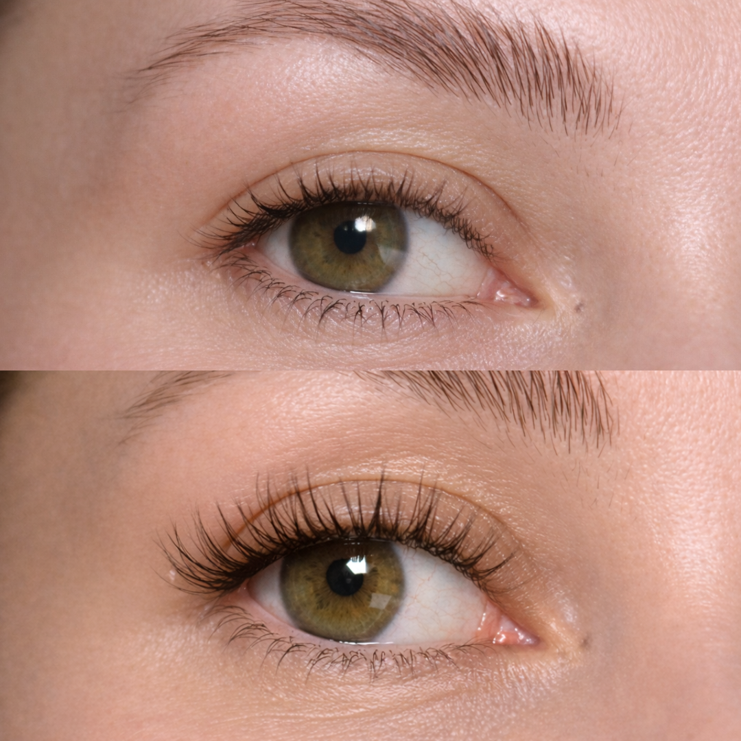 Fransförlängningskluster (14d)