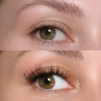 Fransförlängningskluster (14d)