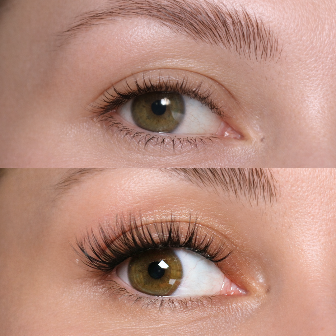 Fransförlängningskluster (14d)